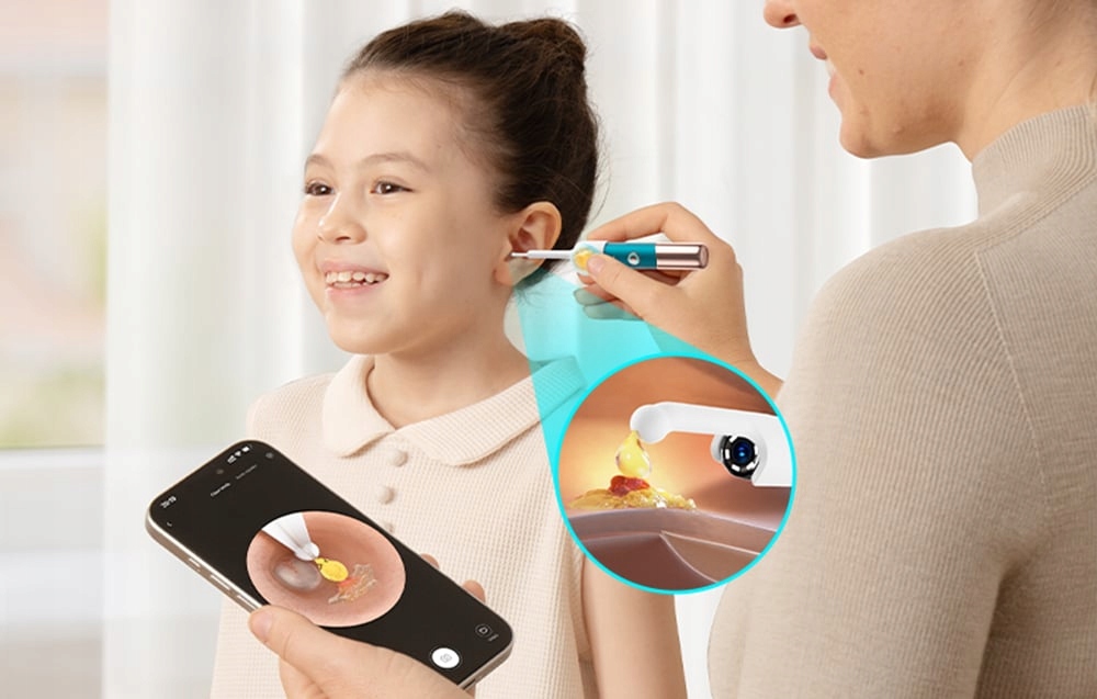 Bebird Earsight Ultra otoskopas kamera 20mp 5g Peseta Endoskopas Silikonas 36mm belsilt Bebird Earsight Ultra otoskopas kamera 20mp 5g Peseta Endoskopas Silikonas 36mm