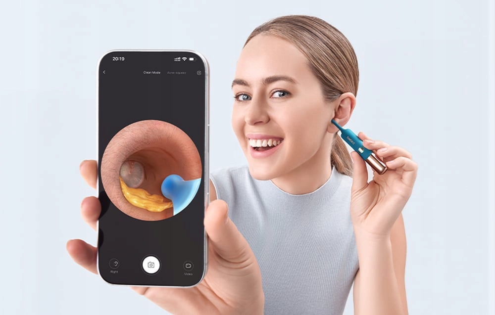 Bebird Earsight Ultra otoskopas kamera 20mp 5g Peseta Endoskopas Silikonas 36mm belsilt Bebird Earsight Ultra otoskopas kamera 20mp 5g Peseta Endoskopas Silikonas 36mm
