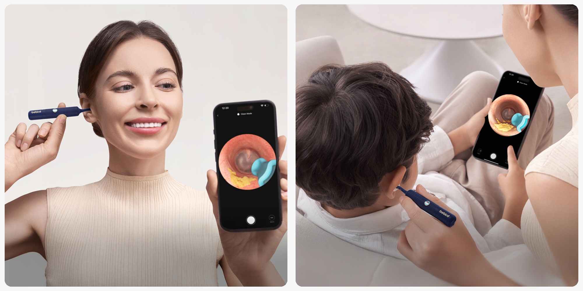 Rinkinys išmanusis otoskopas su kamera ausų valymui Bebird Earsight Plus belsilt Rinkinys išmanusis otoskopas su kamera ausų valymui Bebird Earsight Plus